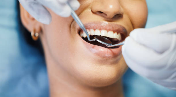 Best Knocked-Out Tooth Emergency  in Fairview, GA