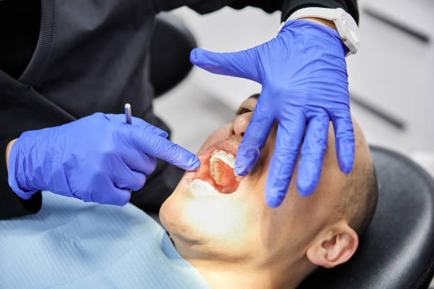 Tooth Infection Emergency Dentist in GA